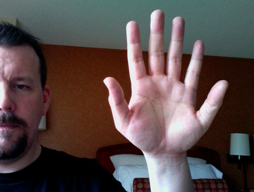 6 Fingers for Flickr's 6th
