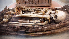 Mummy bones