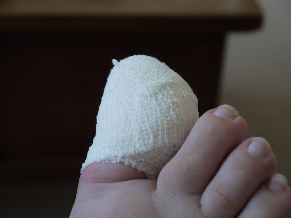 Day Thirty Eight - Sore Toe