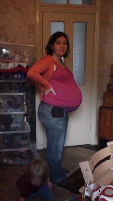I'm only putting this photo up so you can see how huge the bump has become.