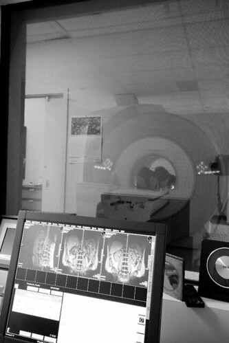 Wide Open Bore MRI