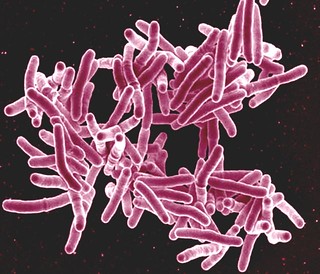 Mycobacterium tuberculosis Bacteria, the Cause of TB