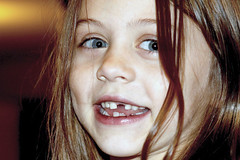 Girl with Missing Teeth