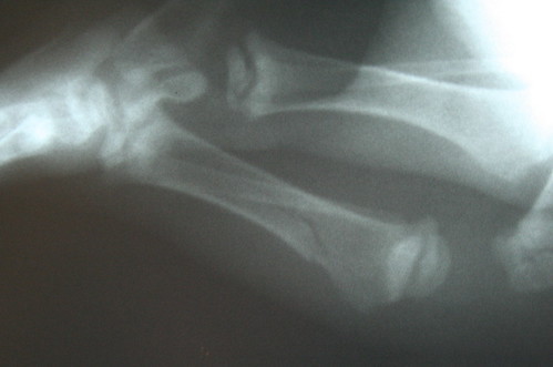 puppy tibia fracture brokenbone