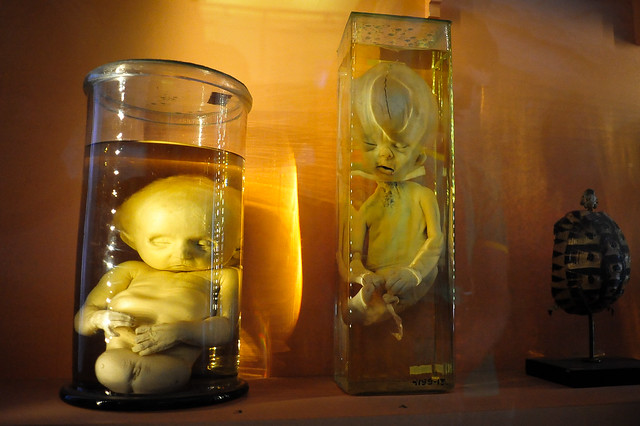 Scientific Collection of Kunstkamera: Fetal Deformaties
