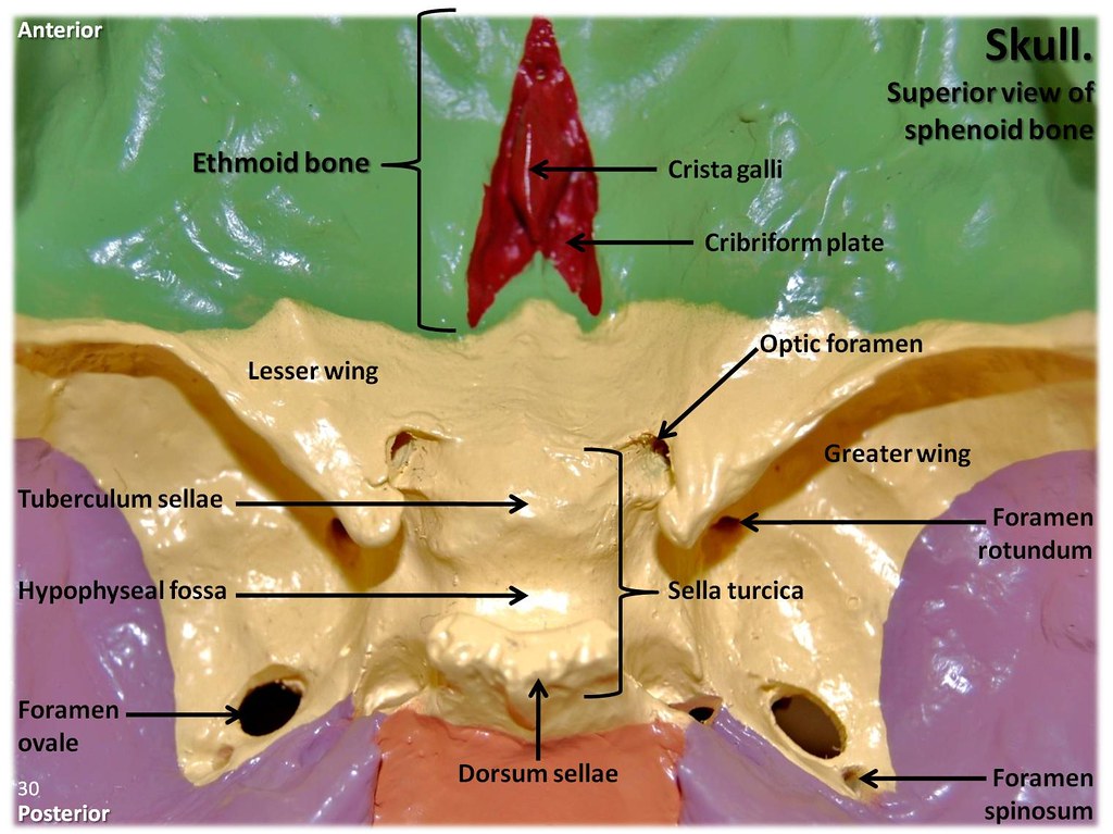 ethmoid bone in skull
