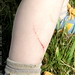 sequoia scratched his leg on a blackberry bush