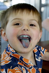 blue tongue from ice cream 