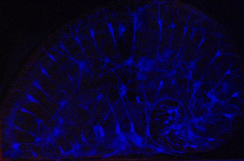 El cerebro, la gran cepa azul