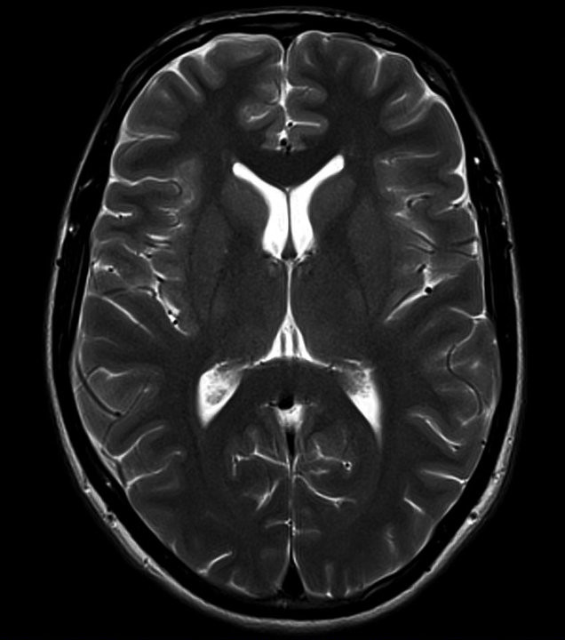 Brain - Aim Medical Imaging