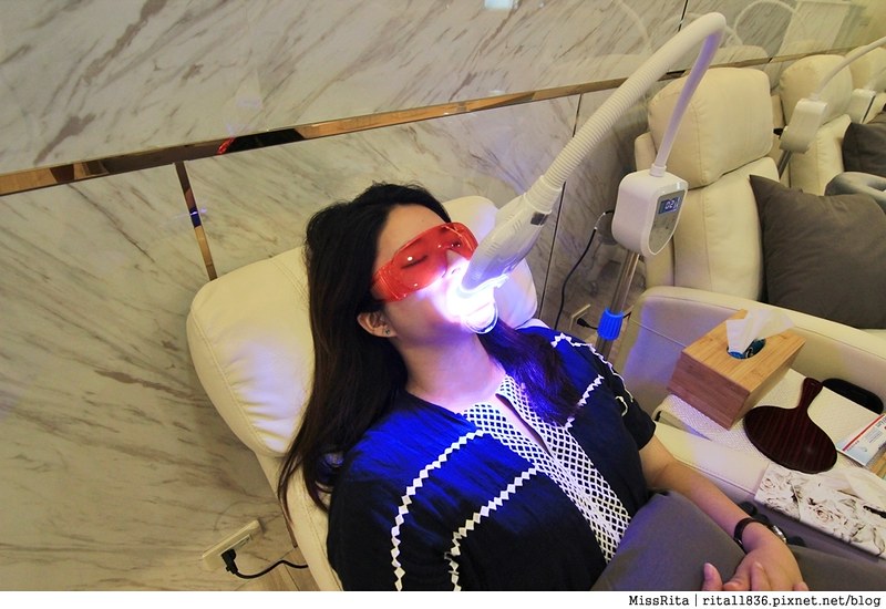 Dr.Min美齒專家 台中美白牙齒 美白牙齒 美齒專家 牙齒美白推薦6