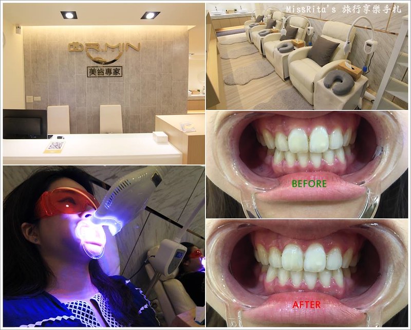 Dr.Min美齒專家 台中美白牙齒 美白牙齒 美齒專家 牙齒美白推薦0