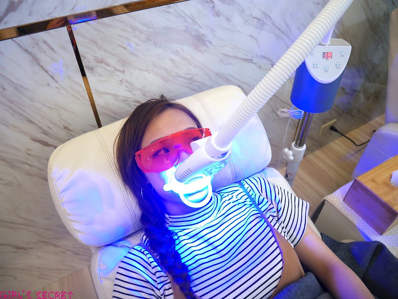 牙齒美白過程-台中牙齒美白推薦
