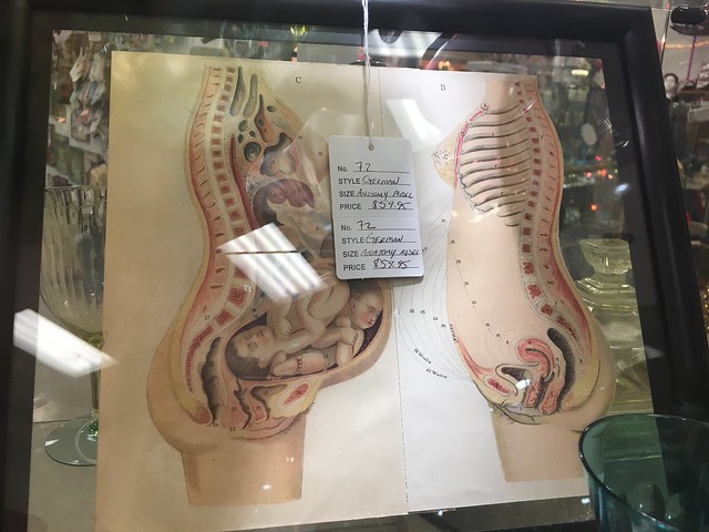 LV 318 pregnant / anatomy