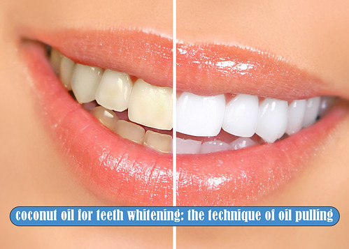 Coconut oil for teeth whitening: the technique of oil pulling