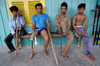 Amputees at Kien Khleang rehabilitation center