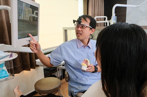 [專欄分享] 為什麼台南遠傳牙醫的陶瓷貼片可以保留齒質壽命更長