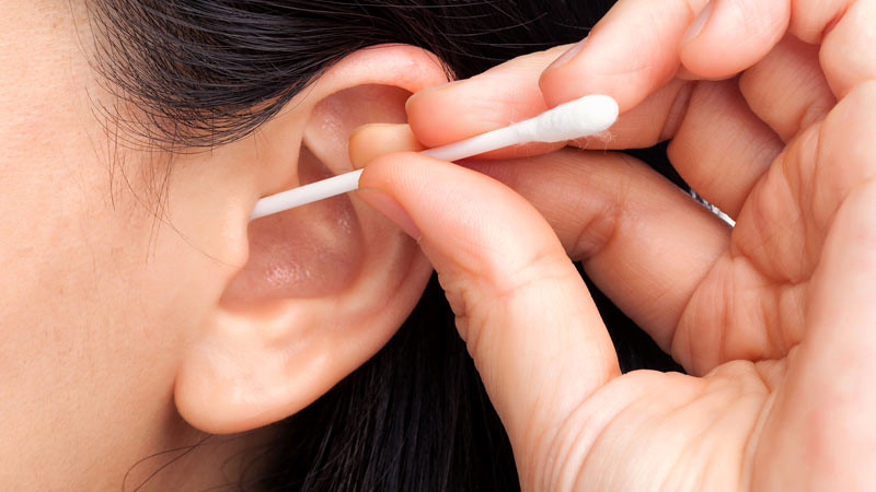 Warna kotoran telinga yang bisa menunjukkan kesehatan Anda.