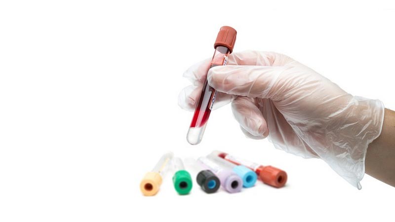 Sampel darah dapat digunakan untuk megetahui gaya hiduo seseorang.