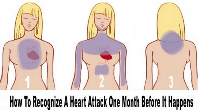 2721 4 things that happen to your body before Heart Attack